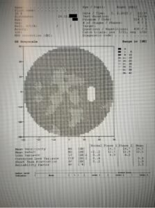 Opthalmology Eye Scanner